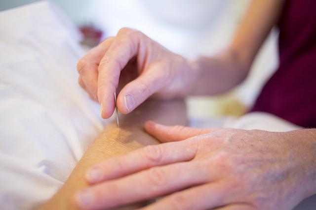 acupuncture holistic health