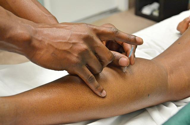 acupuncture image